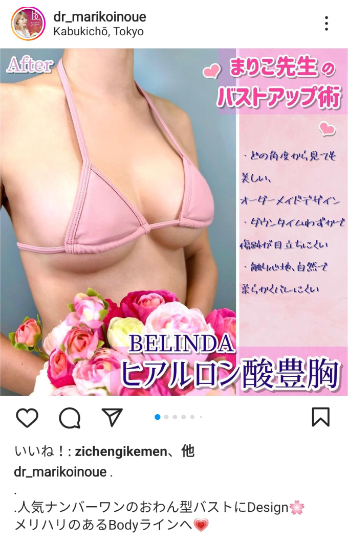 インスタグラムの症例_01